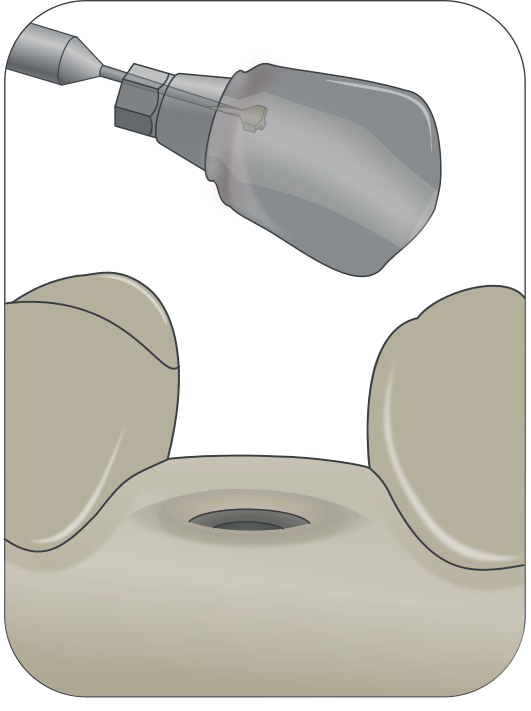 PDU_CAD_DI_5